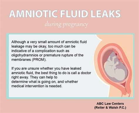 leaking amniotic fluid symptoms|Leaking Amniotic Fluid: Signs, Causes, and。